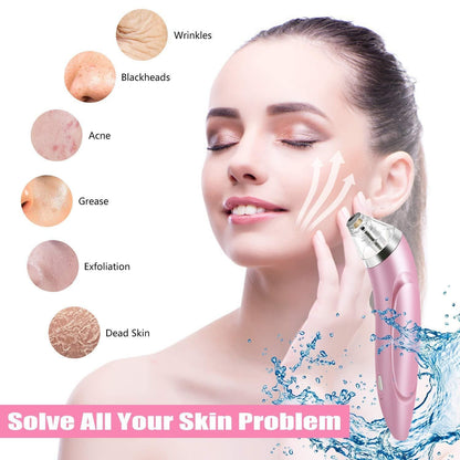 Vacuum acne pore cleaner demonstrating effective removal of blackheads and dead skin for clear skin